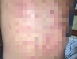 Anaknya Diduga Jadi Korban Penganiayaan, Bapak Ini Akan Lapor ke Polres