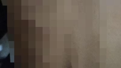 Ngeri! Santri di Cibinong Ini Jadi Korban Kekerasan Seniornya di Ponpes