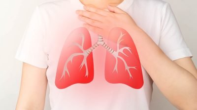 Waspada! 5 Kebiasaan Sehari-hari Ini Bisa Sebabkan Paru-paru Basah