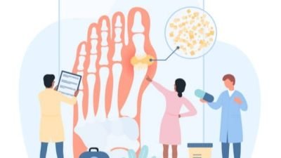 Inilah 5 Cara Cegah Asam Urat Kambuh Saat Lebaran