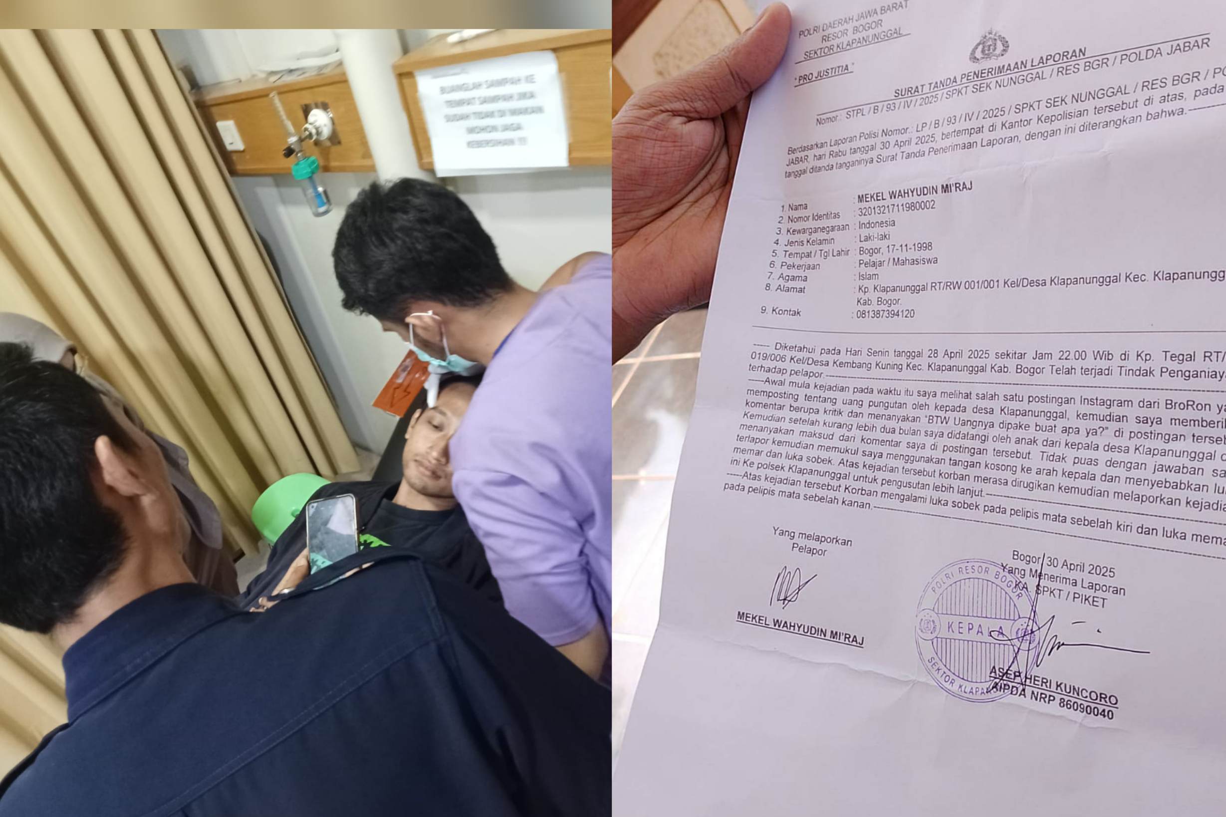 Usai Dianiaya, Korban Laporkan Anak Kades Klapanunggal ke Polisi
