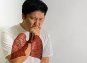 Kasus TBC di Kota Bogor Meningkat Tajam