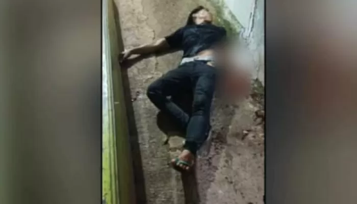 Pertengkaran Hebat Pasutri di Klapanunggal, Istri Tusuk Suami dengan Gunting